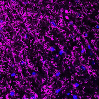 Myelin Basic Protein (MBP) Antibody