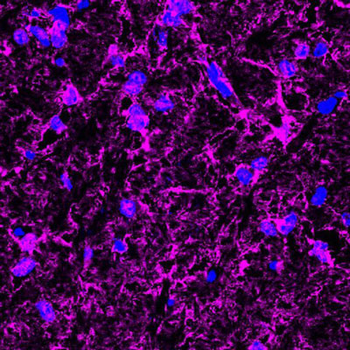 Myelin Basic Protein (MBP) Antibody
