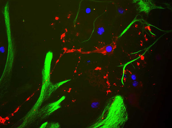 Myelin Basic Protein (MBP) Antibody