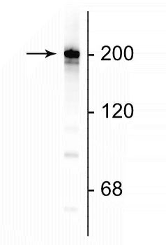 Neurofilament NF-H Antibody