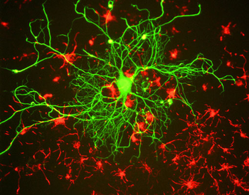 Neurofilament NF-L Antibody