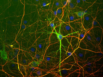 Neurofilament NF-L Antibody