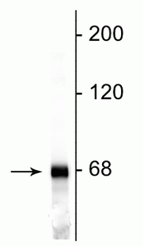 Neurofilament NF-L Antibody
