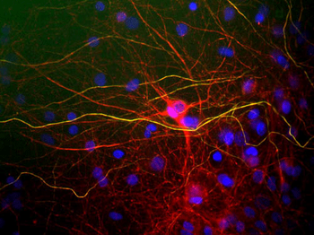 Neurofilament NF-L Antibody
