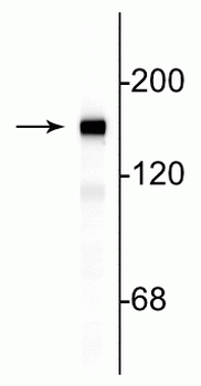 Neurofilament NF-M Antibody