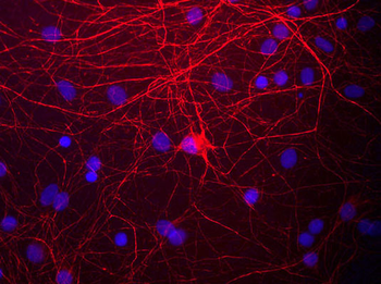 Neurofilament NF-M Antibody