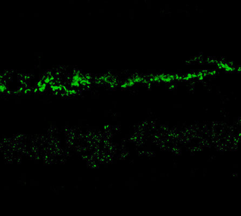 NMDA NR2A Subunit (100 ul) Antibody