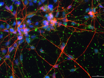 NMDA NR2B Subunit Antibody