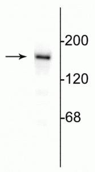 NMDA NR2B Subunit Antibody