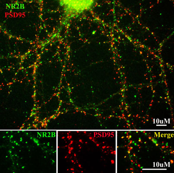 NMDA NR2B Subunit, N-terminus Antibody