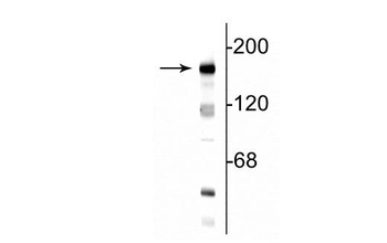 NMDA NR2B Subunit, N-terminus Antibody