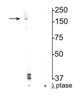 NMDA NR2B Subunit (Ser1166) Antibody