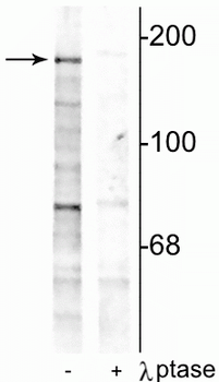 NMDA NR2B Subunit (Tyr1252) Antibody