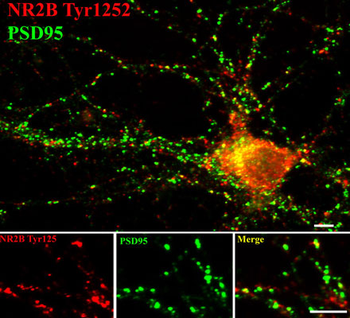 NMDA NR2B Subunit (Tyr1252) Antibody