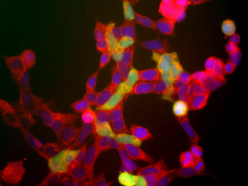 NSE (Neuron specific enolase) Antibody