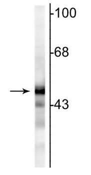 NSE (Neuron specific enolase) Antibody