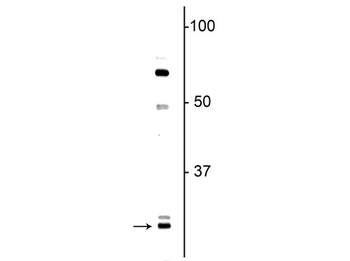 Olig1 Antibody