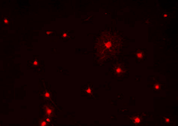 Olig1 Antibody