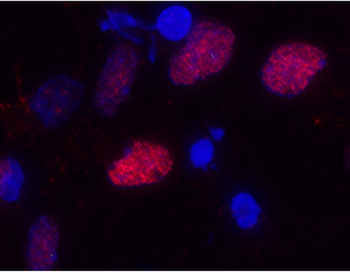 Olig2 Antibody