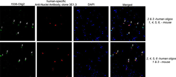 Olig2 Antibody