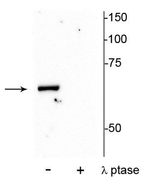 PAK-1 (Thr84) Antibody