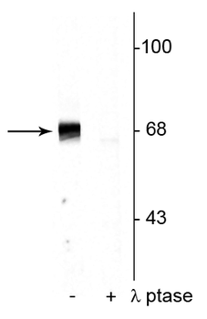 PAK-1,2,3 (Thr402) Antibody