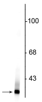 Park7 (DJ-1) Antibody
