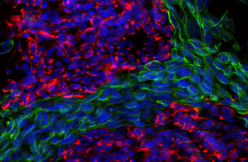 Peripherin Antibody