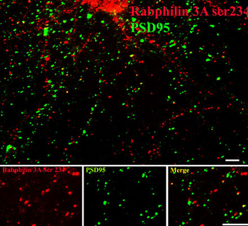 Rabphilin 3A (Ser234) Antibody