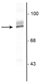 Ribosomal S6 kinase 2 Antibody