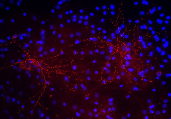 Synaptophysin 2 Antibody