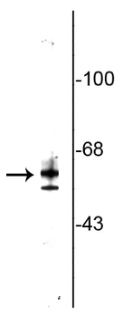 Testicular Receptor 2 (TR2) Antibody