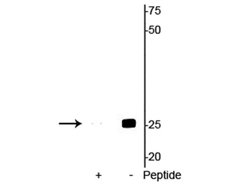 Troponin I (cardiac) Ser23/24 Antibody
