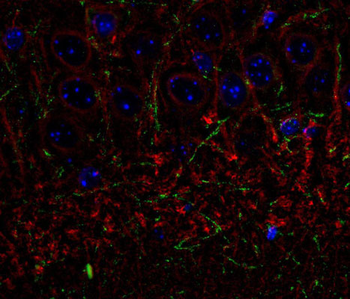 Tubulin, beta III Antibody