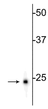 Ubiquitin C-terminal Hydrolase 1 (UCHL1) Antibody