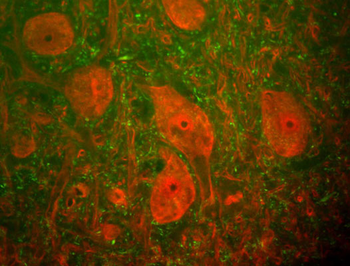Ubiquitin C-terminal Hydrolase 1 (UCHL1) Antibody