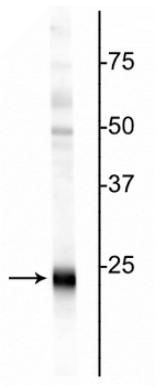 Ubiquitin C-terminal Hydrolase 1 (UCHL1) Antibody