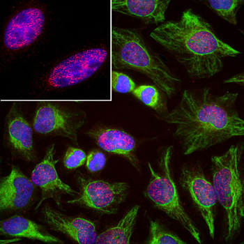 Vimentin Antibody