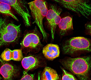 Vimentin Antibody