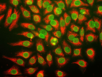 Vimentin Antibody