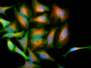 Vimentin Antibody