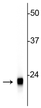 Visinin-Like Protein 1 (VSNL1) Antibody