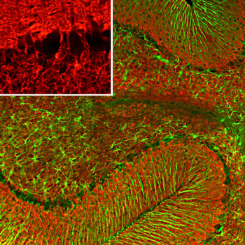 Visinin-Like Protein 1 (VSNL1) Antibody