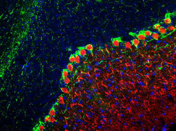 Calbindin Antibody