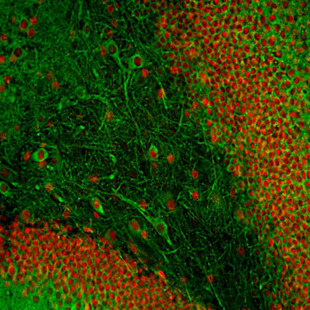 Microtubule Associated Protein 2 C/D (MAP2C/D) Antibody