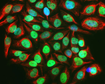 c-FOS Antibody