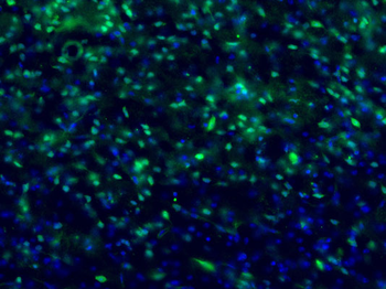 c-FOS Antibody