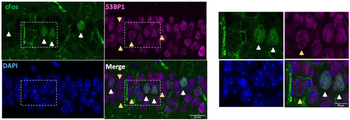c-FOS Antibody