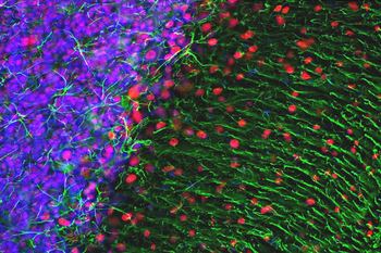 MeCP2 Antibody