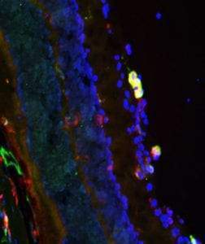 Arginase I (ARG1) Antibody